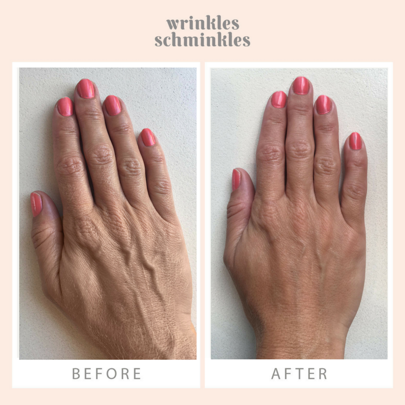 Hand Smoothing Kit